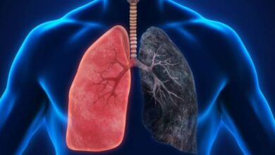 Salud Global/ Dejar de fumar No borra las huellas del tabaco en los pulmones